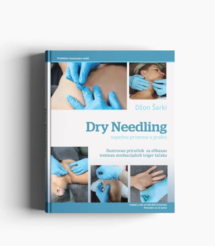 Dry Needling